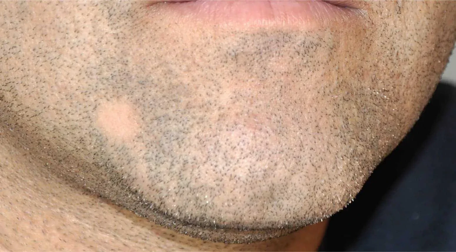img/388_bald-head-beard-styles-a-guide-to-rocking-the-look.webp