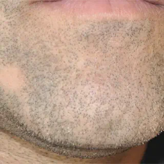 img/388_bald-head-beard-styles-a-guide-to-rocking-the-look.webp